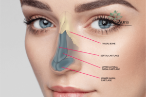 Rhinoplasty East Delhi