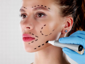 Plastic Surgery in Delhi