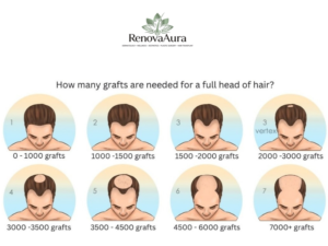 Hair Transplant Grafts